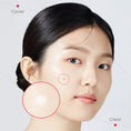 Load image into Gallery viewer, Dr.G A'Clear Ultra Thin Spot Patch 30ea