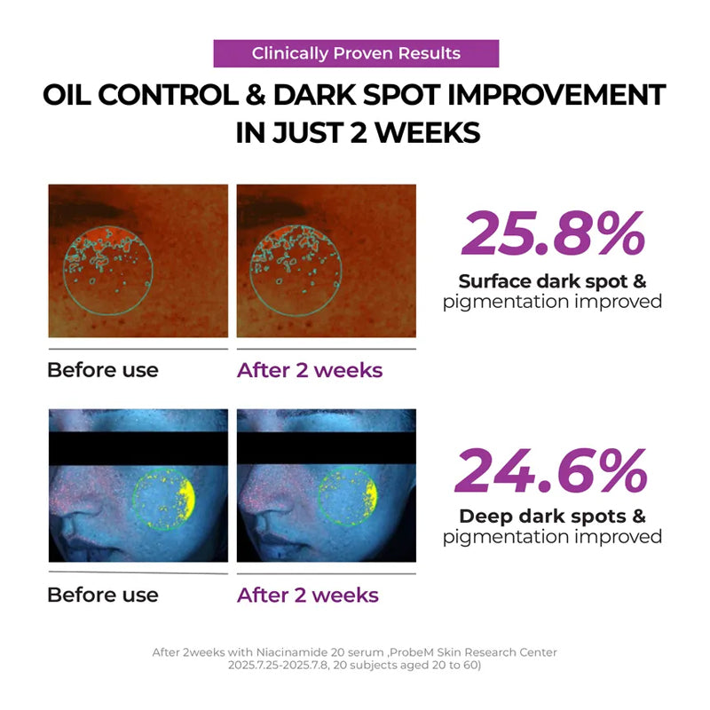 Jumiso Niacinamide 2+ Oil Control Cream 80ml