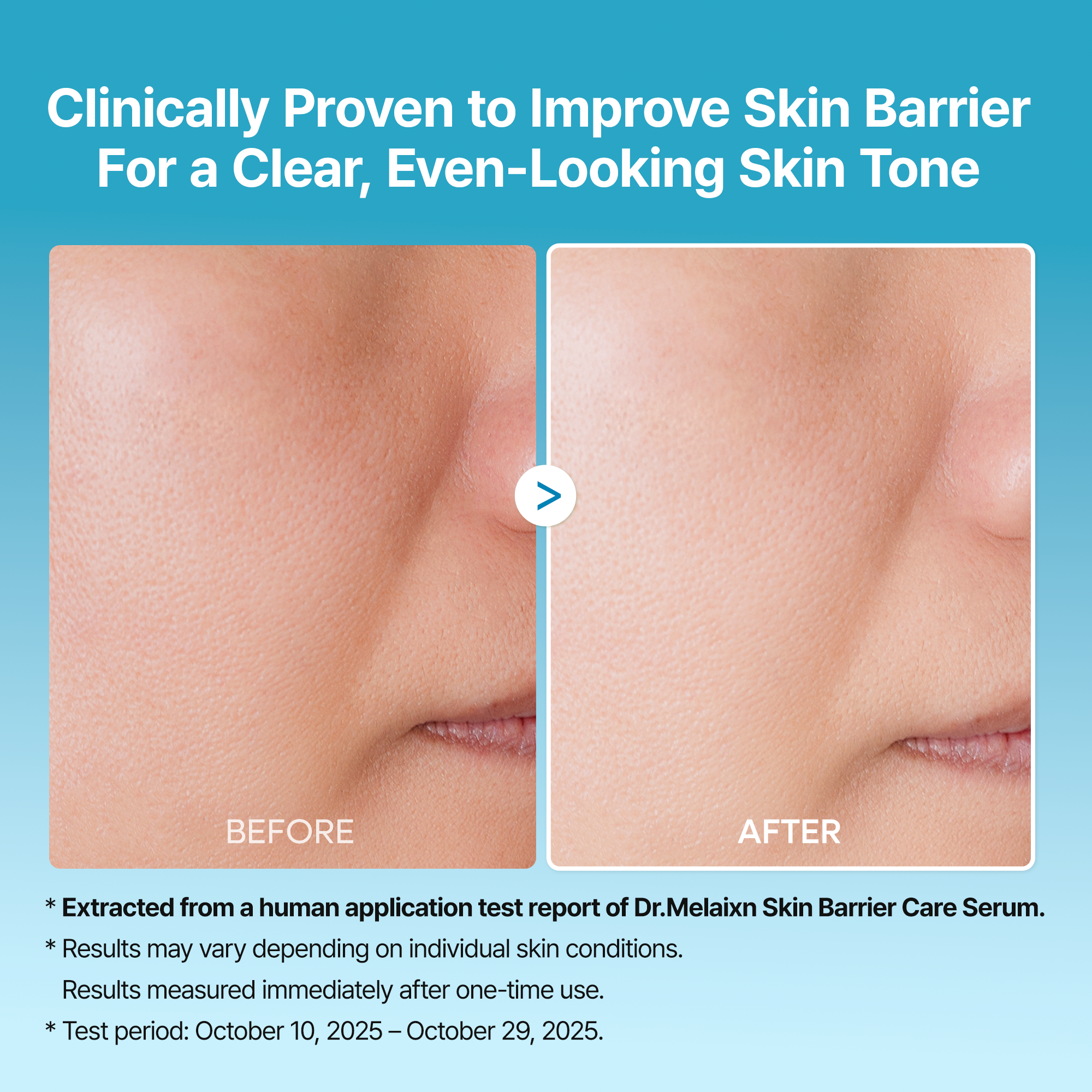 Dr.Melaxin Peel Shot Exfoliating TX-Serum 80ml