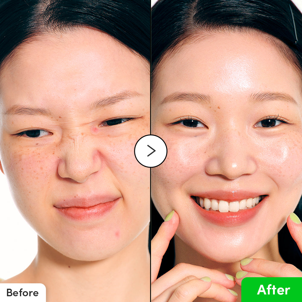 Eqqualberry Aloe PDRN Calming Serum 30ml