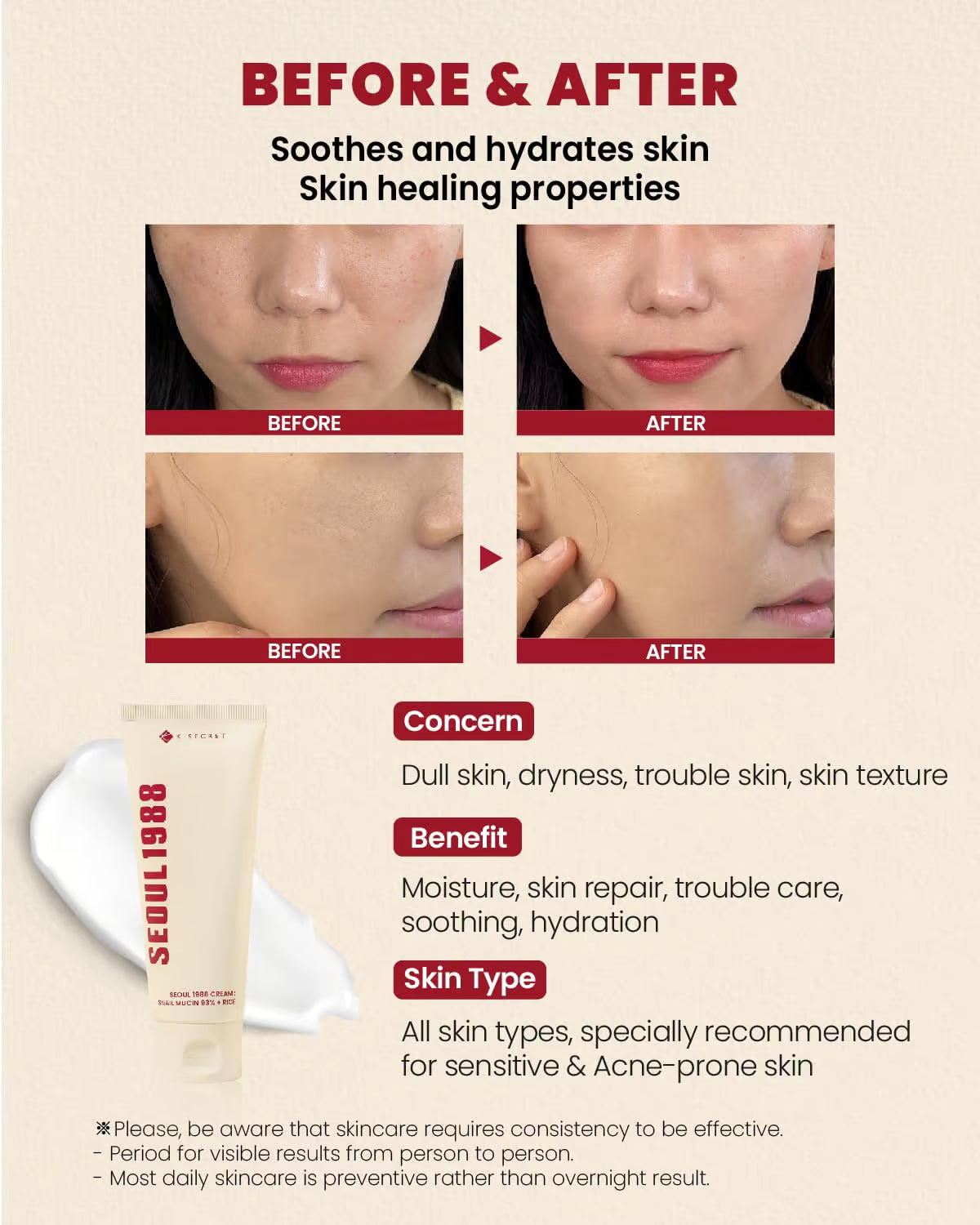 K-Secret Seoul 1988 Cream : Snail Mucin 93% + Rice 100ml