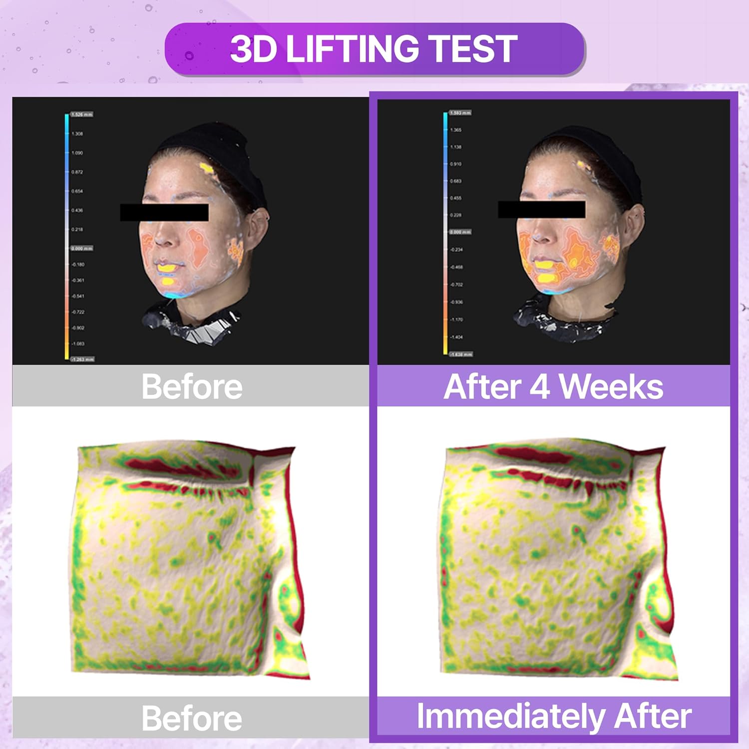 Bioheal BOH Probioderm 3D Lifting Essential Toner 150ml