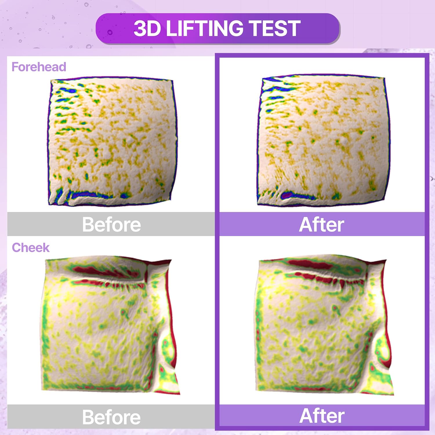 Bioheal BOH Probioderm 3D Lifting Emulsion 150ml