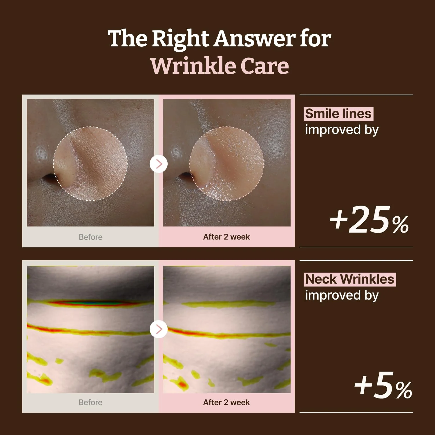 Dr.Reju-All Advanced Pdrn Rejuvenating Mask 4Pcs