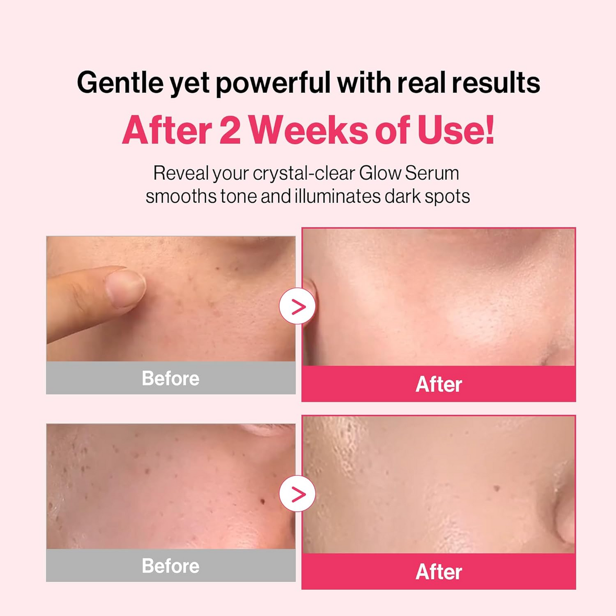 Redence Tone&Spot Corrector Ampoule 30ml