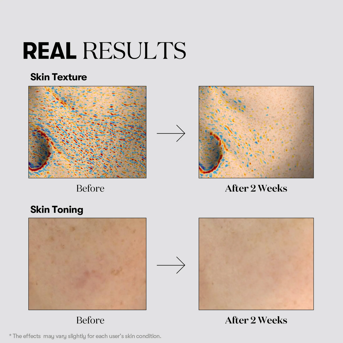 VT Cosmetics TX-toning Essence 1000 Shot 30ml