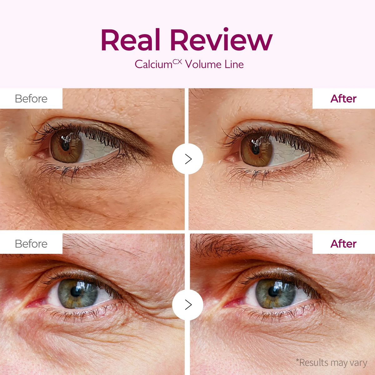 Dr.Melaxin Calcium Volume Eye Patch 60 patches