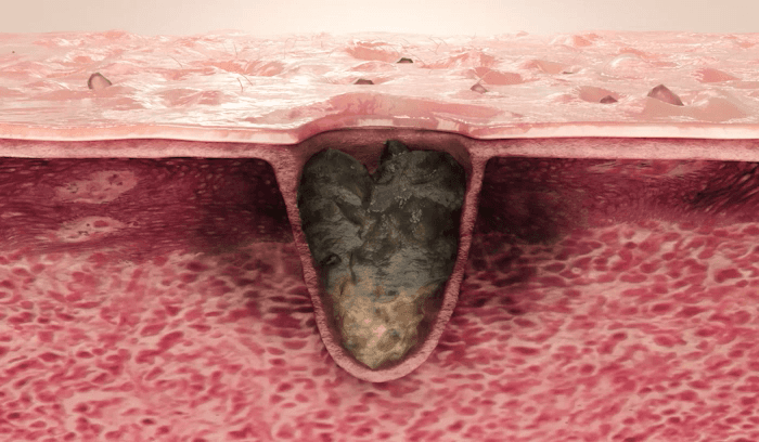 Medicube Zero Pore Pad 70Pcs