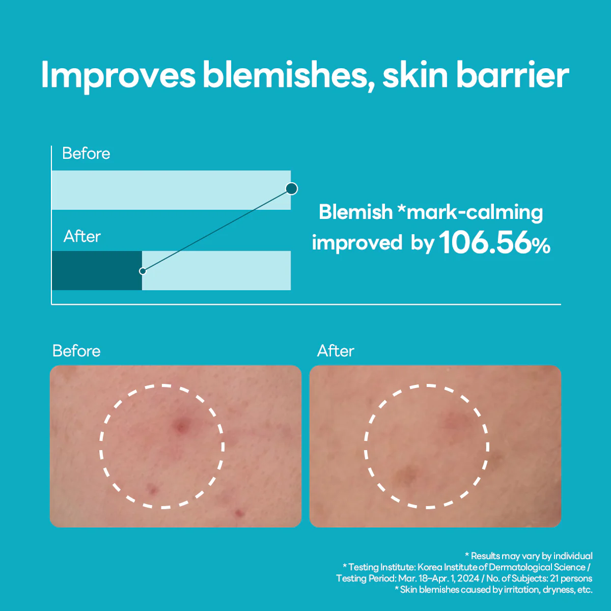 Mediheal Madecassoside Blemish Repair Serum 40ml