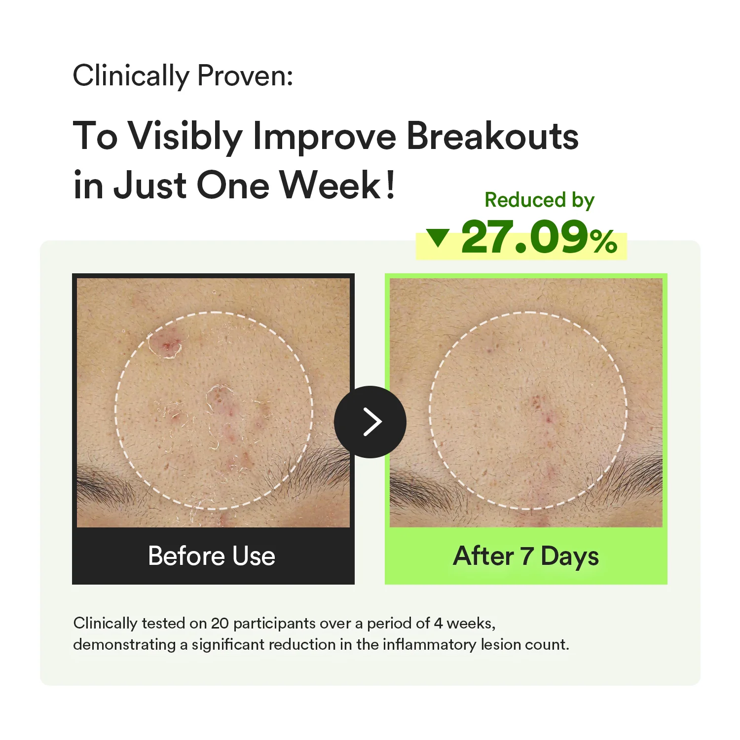 Abib Heartleaf Teca Capsule Serum Calming Drop 50ml