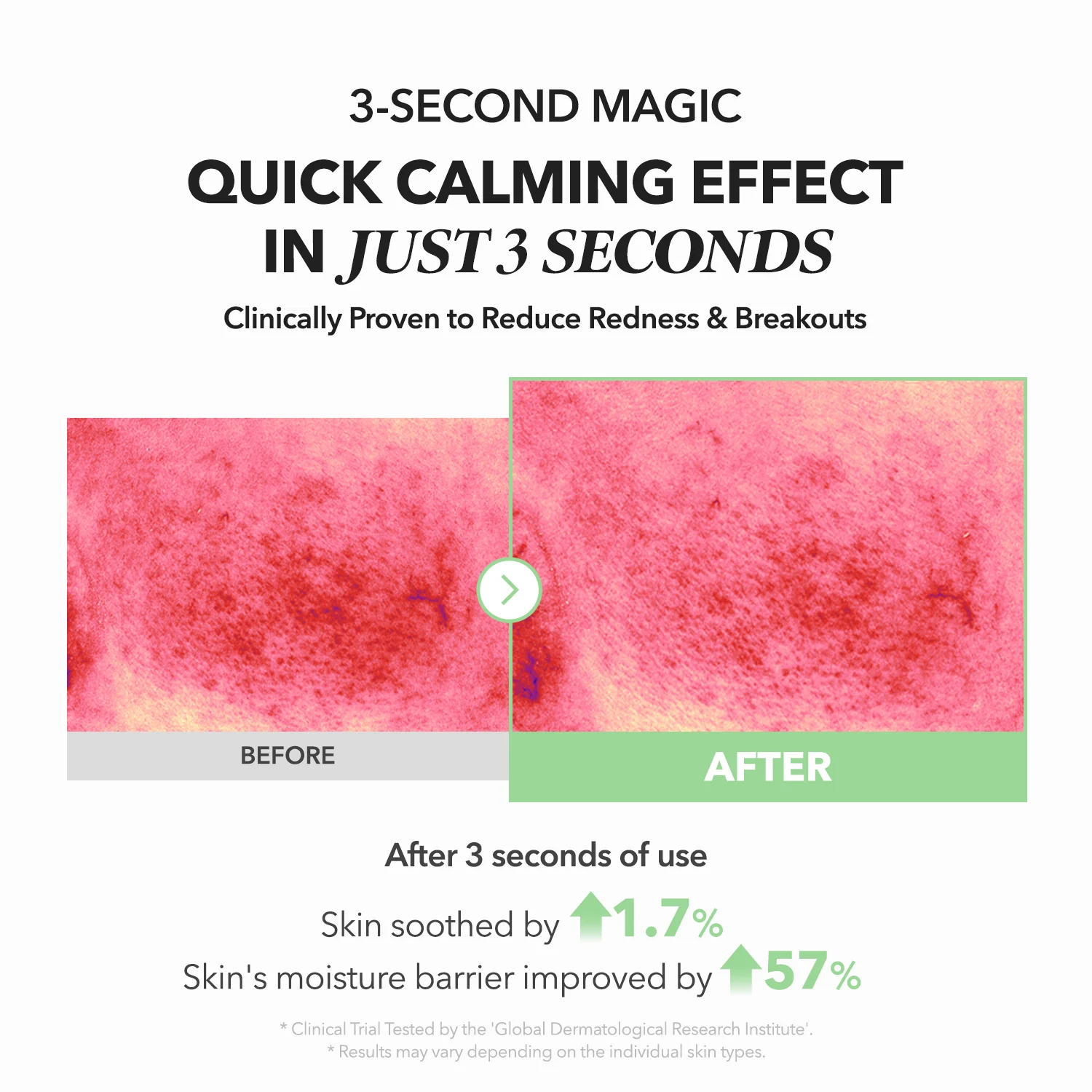 April Skin Ace Mugwort Centella Caling Serum 110g