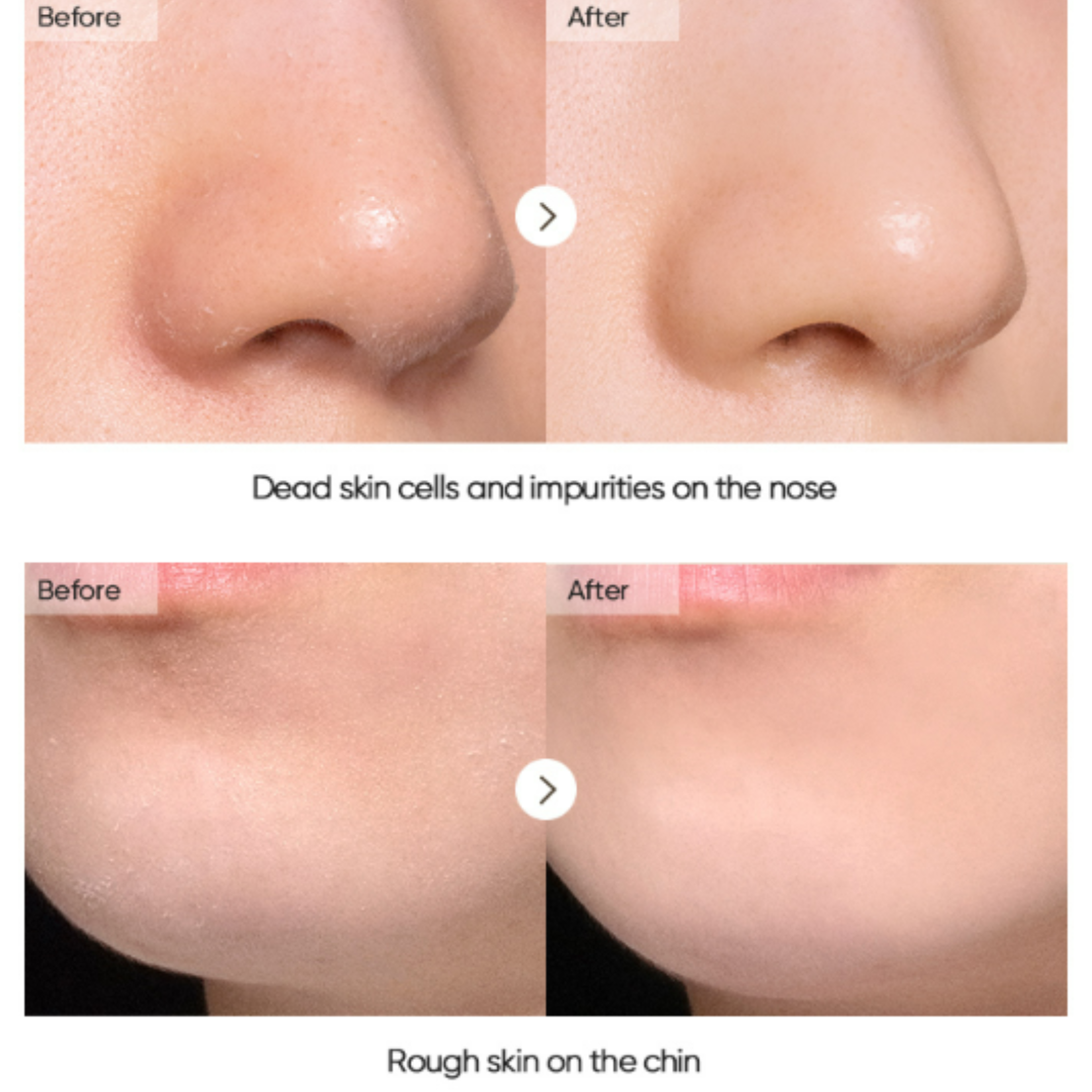 Banila Co Clean It Zero Brightening Peeling Gel 120ml